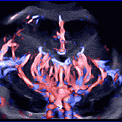 Комплексное УЗИ Щитовидная железа, Брюшная полость,,Молочные железы(ж),Органы малого таза, Почки   Сосуды головы,    Сосуды мозга   УЗИ сердца